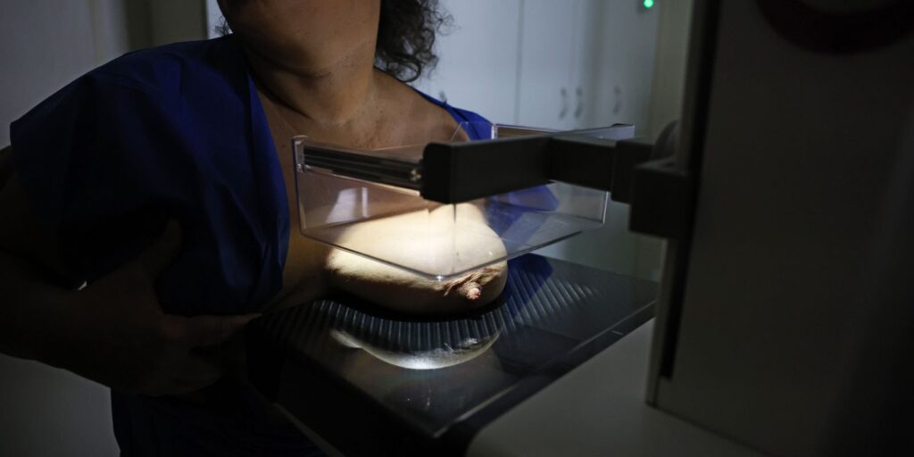 ans-defende-que-plano-cubra-mamografia-digital-sem-restricao-de-idade