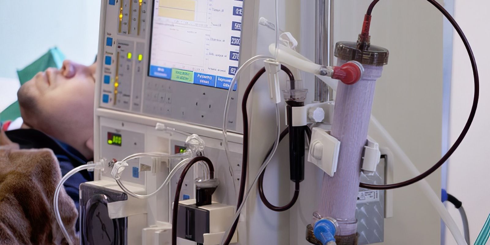 estudo-alerta-para-subdiagnostico-da-doenca-renal-cronica-no-brasil