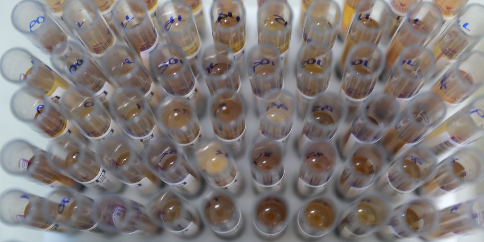 uso-de-medicamento-oferecido-no-sus-reduz-casos-de-malaria-no-brasil