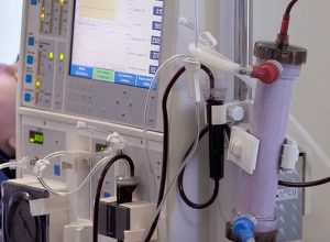 estudo-alerta-para-subdiagnostico-da-doenca-renal-cronica-no-brasil